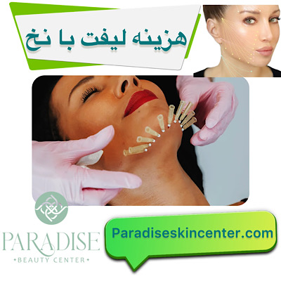 هزینه لیفت با نخ