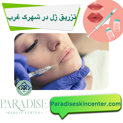 تزریق ژل در شهرک غرب
