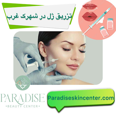تزریق ژل در شهرک غرب