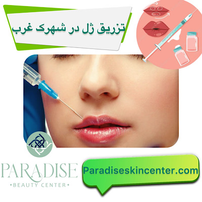 تزریق ژل در شهرک غرب