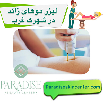 لیزر موهای زائد در شهرک غرب