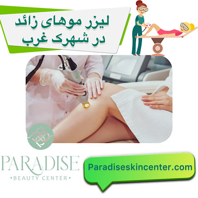 لیزر موهای زائد در شهرک غرب