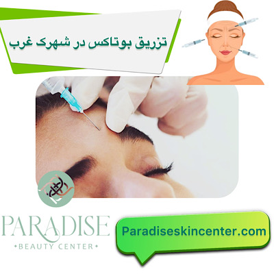 تزریق بوتاکس در شهرک غرب