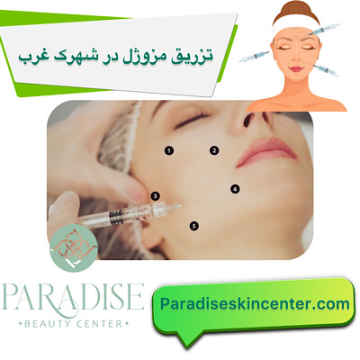 تزریق مزوژل در شهرک غرب