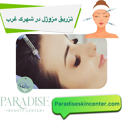 تزریق مزوژل در شهرک غرب
