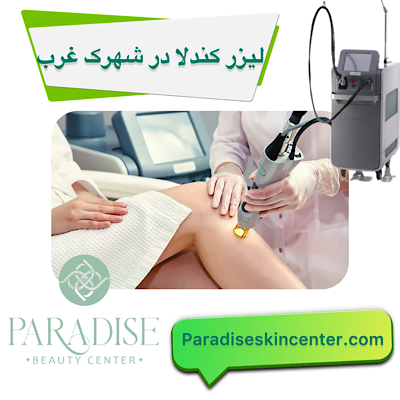 لیزر کندلا در شهرک غرب