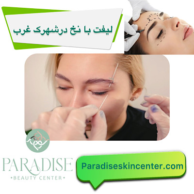  لیفت با نخ در شهرک غرب