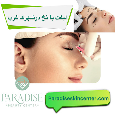 لیفت با نخ در شهرک غرب