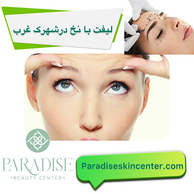  لیفت با نخ در شهرک غرب