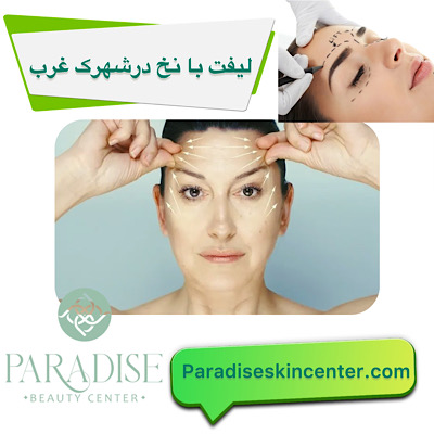  لیفت با نخ در شهرک غرب