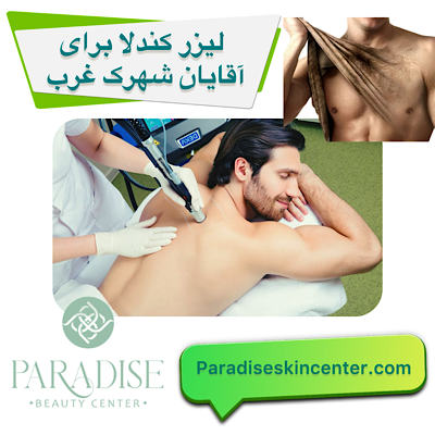لیزر کندلا برای آقایان در شهرک غرب تهران