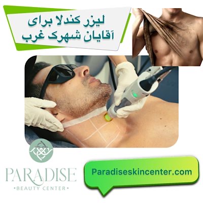 لیزر کندلا برای آقایان در شهرک غرب تهران