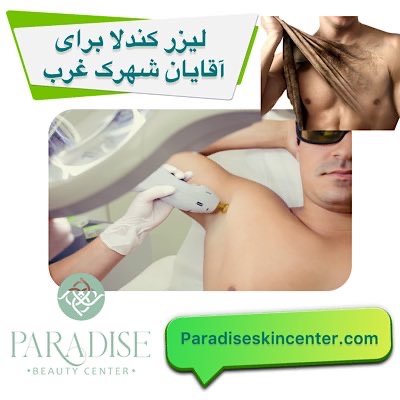 لیزر کندلا برای آقایان در شهرک غرب تهران