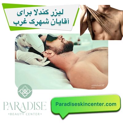 لیزر کندلا برای آقایان در شهرک غرب تهران
