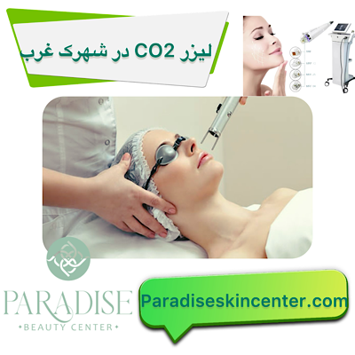 لیزر CO2 در شهرک غرب