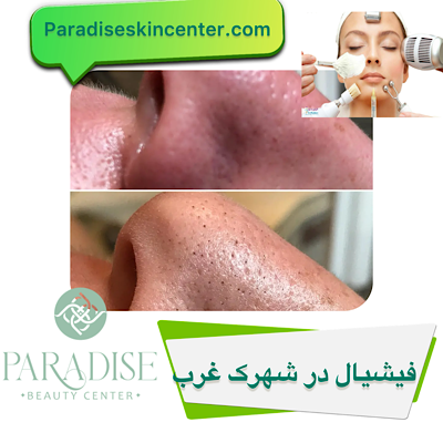 فیشیال در شهرک غرب