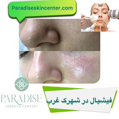 فیشیال در شهرک غرب