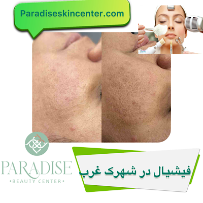 فیشیال در شهرک غرب