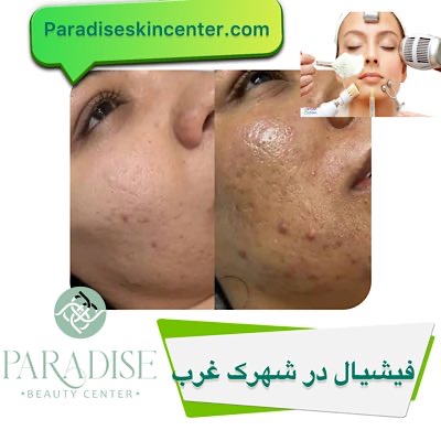 فیشیال در شهرک غرب