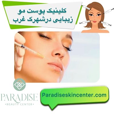 کلینیک پوست مو زیبایی در شهرک غرب