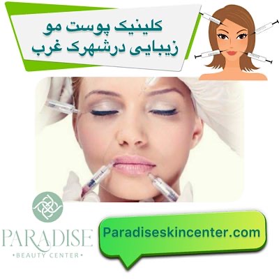 کلینیک پوست مو زیبایی در شهرک غرب