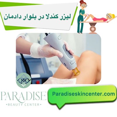 لیزر کندلا در بلوار دادمان