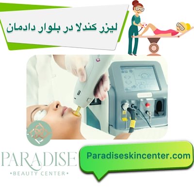لیزر کندلا در بلوار دادمان