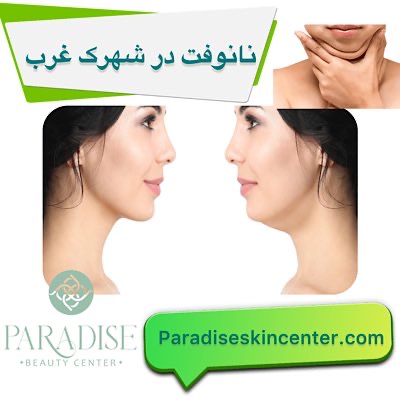 نانوفت در شهرک غرب