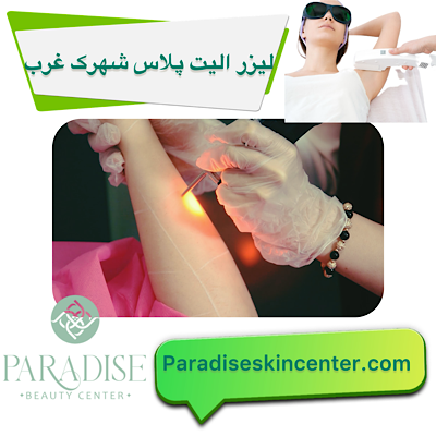 لیزر الیت پلاس در شهرک غرب