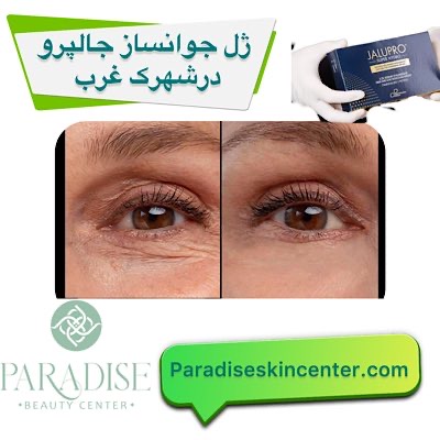 ژل جوانساز جالپرو در شهرک غرب