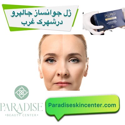 ژل جوانساز جالپرو در شهرک غرب