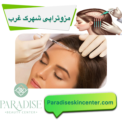 مزوتراپی شهرک غرب