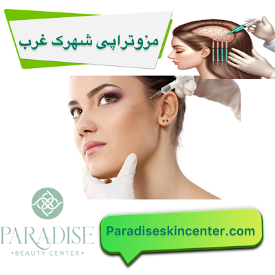 مزوتراپی شهرک غرب