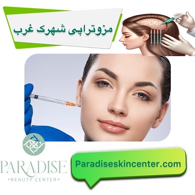 مزوتراپی شهرک غرب
