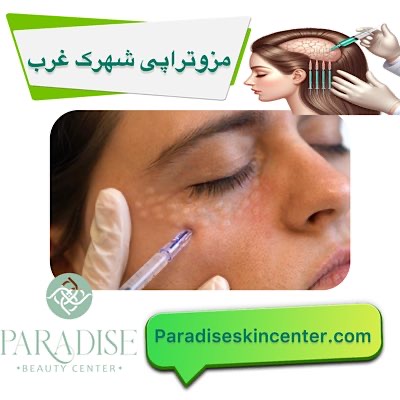مزوتراپی شهرک غرب