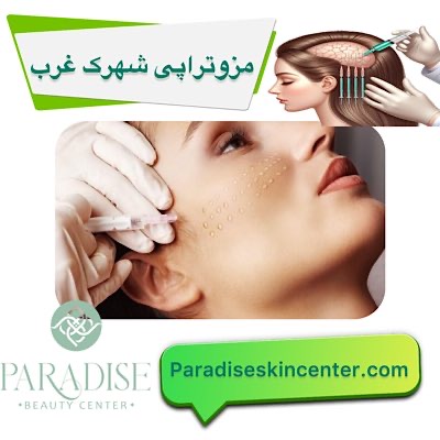 مزوتراپی شهرک غرب