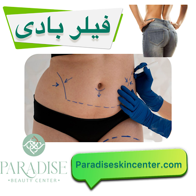 فیلر بادی