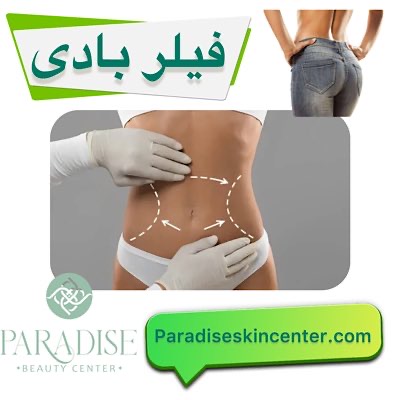 فیلر بادی