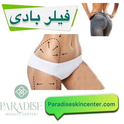 فیلر بادی