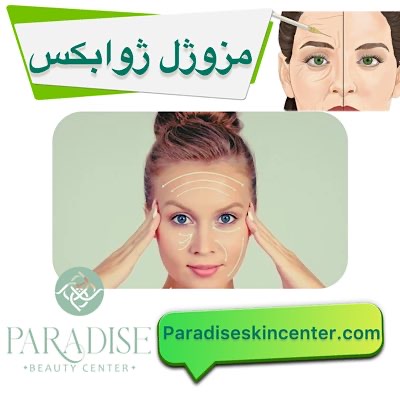 مزوژل ژوابکس
