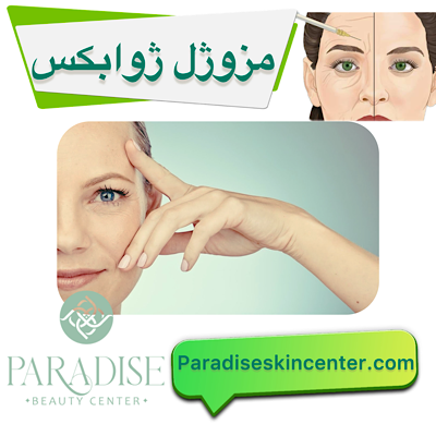 مزوژل ژوابکس