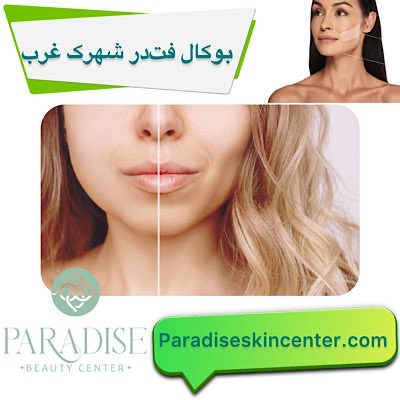 بوکال فت
