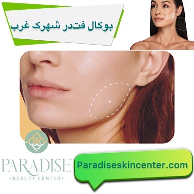 بوکال فت
