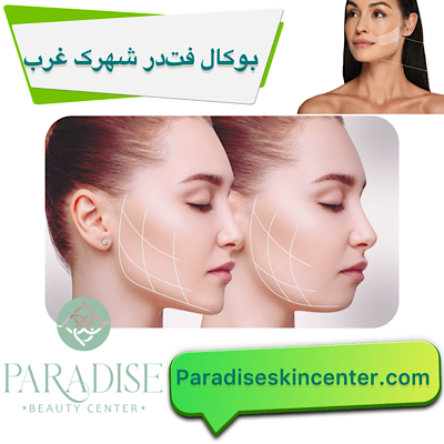 بوکال فت