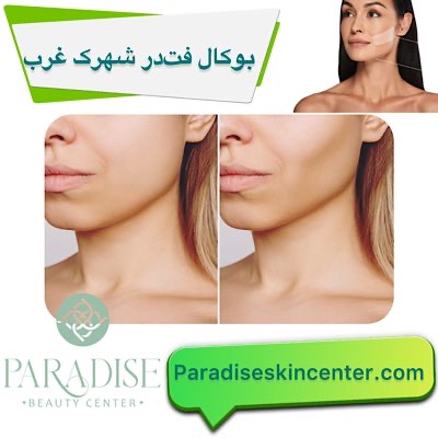 بوکال فت