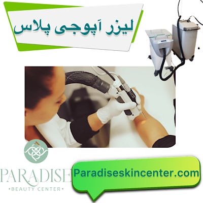 لیزر آپوجی پلاس