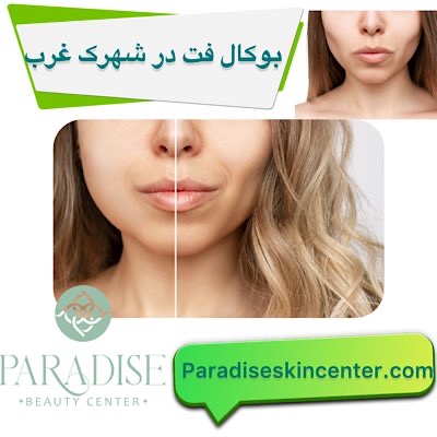 بوکال فت در شهرک غرب
