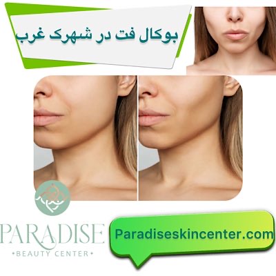 بوکال فت در شهرک غرب