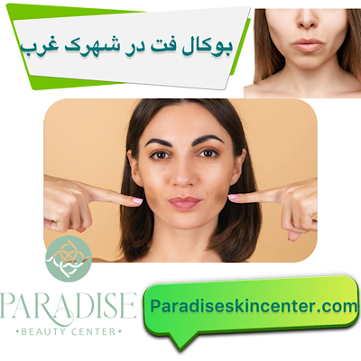 بوکال فت در شهرک غرب