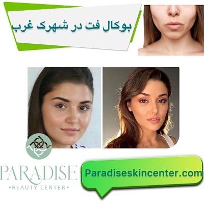 بوکال فت در شهرک غرب